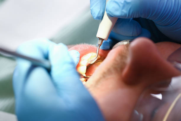 Best Weekend Emergency Dentist in Rancho Viejo, TX